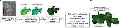 Predicting Vertebral Bone Strength Using Finite Element Analysis for Opportunistic Osteoporosis Screening in Routine Multidetector Computed Tomography Scans—A Feasibility Study